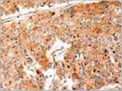 product-image-AAA22000_IHC3.jpg