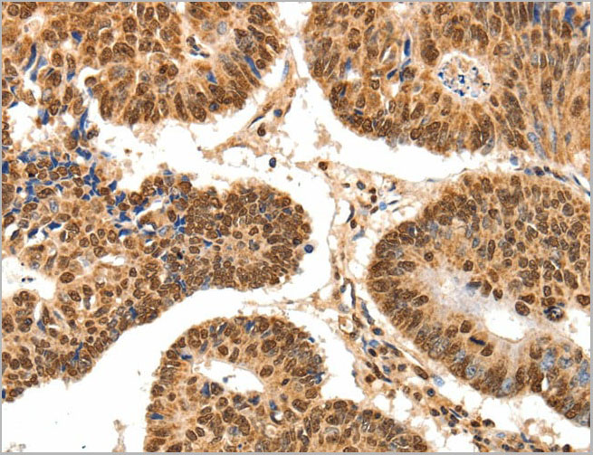 product-image-AAA22001_IHC.jpg