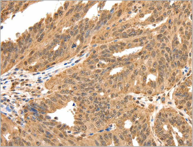 product-image-AAA22001_IHC2.jpg