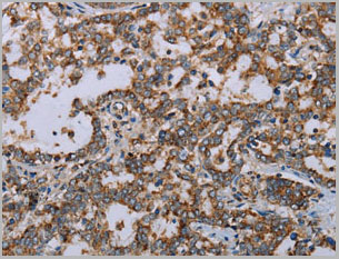 product-image-AAA22002_IHC3.jpg