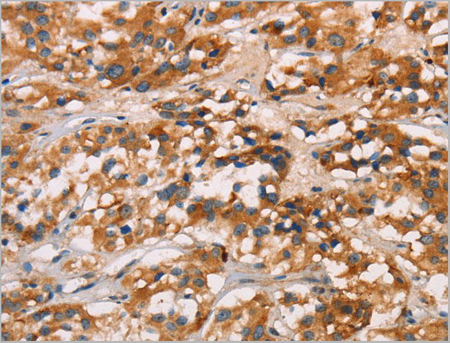 product-image-AAA22004_IHC.jpg