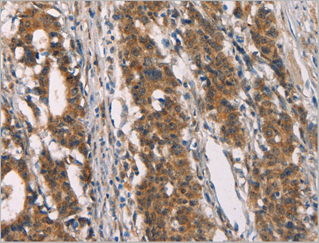 product-image-AAA22004_IHC2.jpg