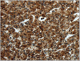 product-image-AAA22005_IHC4.jpg