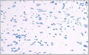 product-image-AAA22005_IHC5.jpg