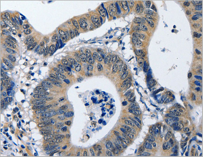 product-image-AAA22008_IHC2.jpg