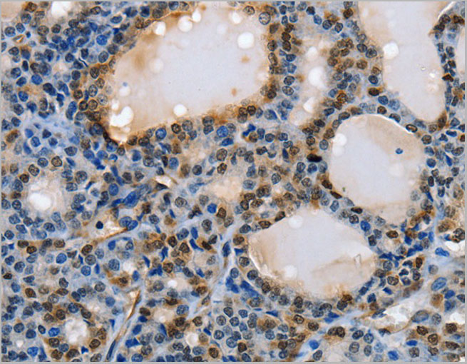 product-image-AAA22008_IHC3.jpg