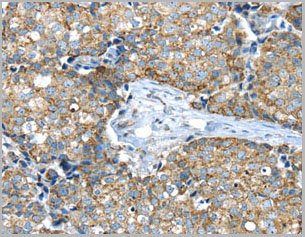 product-image-AAA22009_IHC.jpg
