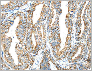 product-image-AAA22009_IHC2.jpg