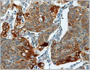 product-image-AAA22010_IHC2.gif