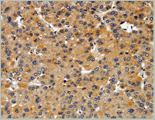 product-image-AAA22010_IHC3.gif