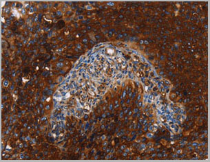 product-image-AAA22012_IHC.jpg