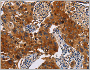 product-image-AAA22012_IHC2.jpg