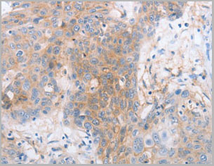 product-image-AAA22013_IHC.jpg