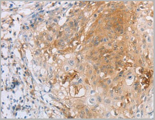product-image-AAA22013_IHC2.jpg