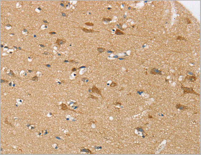 product-image-AAA22015_IHC.jpg