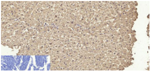 product-image-AAA22058_IHC2.png