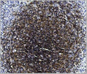 product-image-AAA22088_IHC.jpg