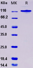product-image-AAA22091_SDS_PAGE.jpg
