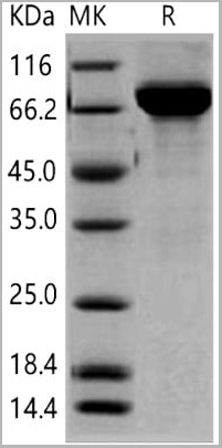 product-image-AAA22096_SDS_PAGE.jpg