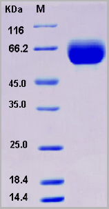 product-image-AAA22099_SDS_PAGE.jpg