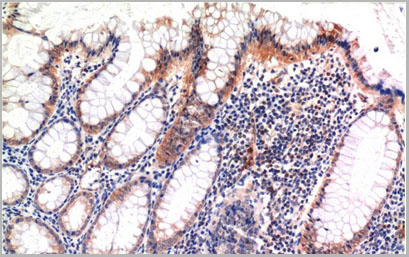 product-image-AAA22113_IHC.jpg
