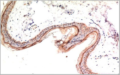 product-image-AAA22113_IHC2.jpg