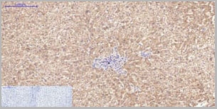 product-image-AAA22114_IHC2.jpg