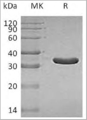 product-image-AAA22118_SDS_PAGE.jpg