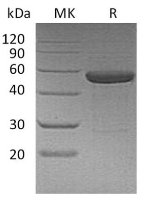 product-image-AAA22119_SDS_PAGE.jpg