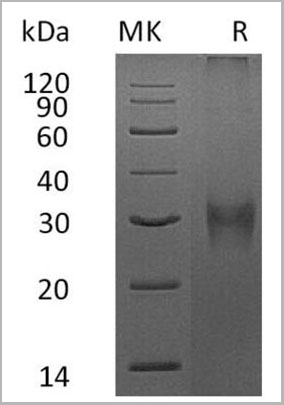 product-image-AAA22120_SDS_PAGE.jpg