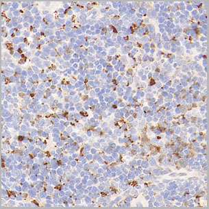 product-image-AAA22122_IHC2.jpg