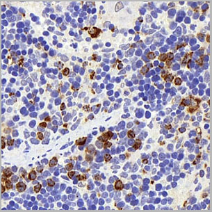 product-image-AAA22122_IHC3.jpg