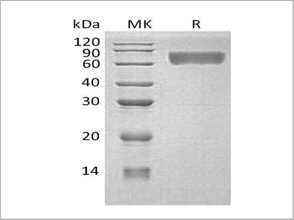 product-image-AAA22125_SDS_PAGE.jpg