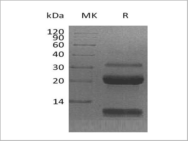 product-image-AAA22126_SDS_PAGE.jpg