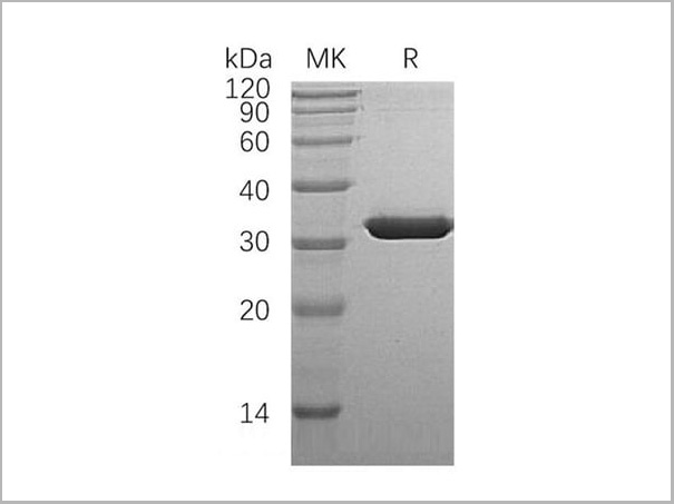 product-image-AAA22127_SDS_PAGE.jpg