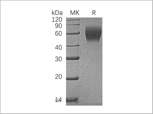 product-image-AAA22128_SDS_PAGE.jpg