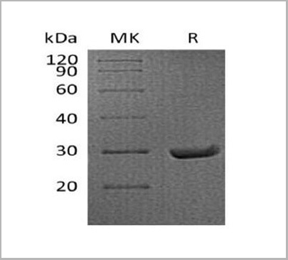 product-image-AAA22130_SDS_PAGE.jpg