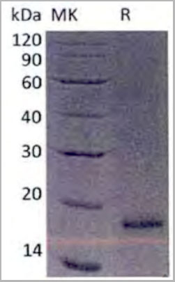 product-image-AAA22135_SDS_PAGE.jpg