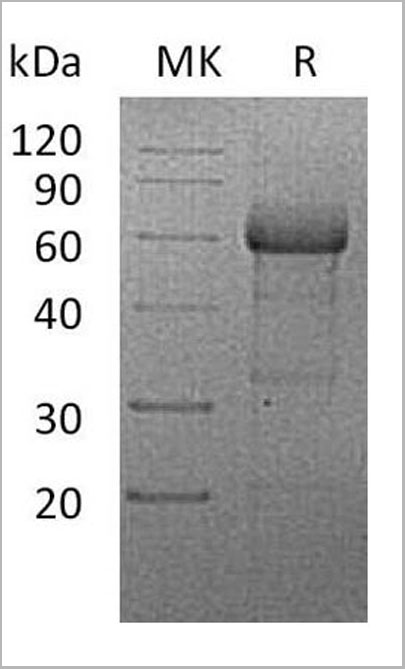 product-image-AAA22136_SDS_PAGE.jpg