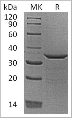product-image-AAA22137_SDS_PAGE.jpg