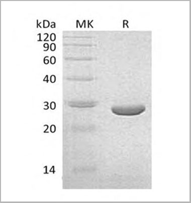 product-image-AAA22138_SDS_PAGE.jpg