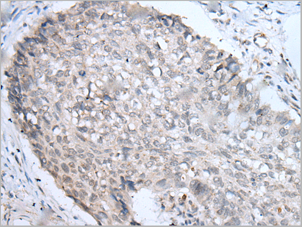 product-image-AAA22140_IHC.png