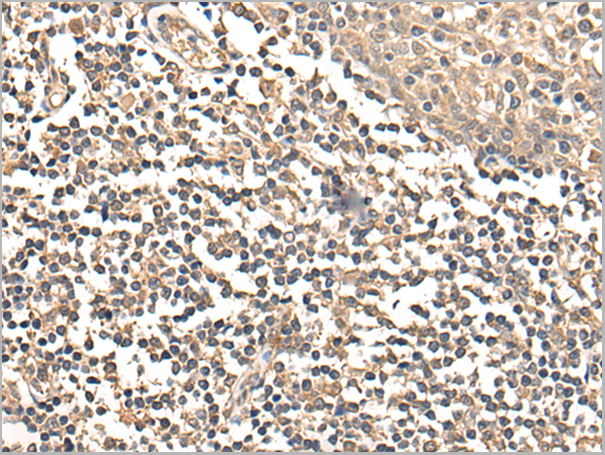 product-image-AAA22141_IHC.png
