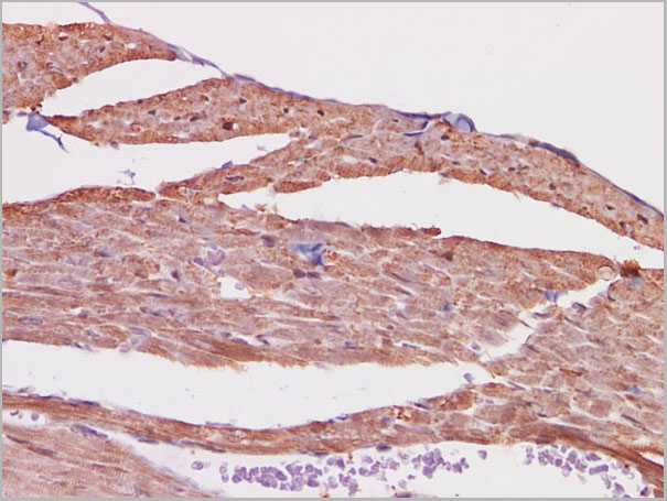 product-image-AAA22143_IHC6.jpg
