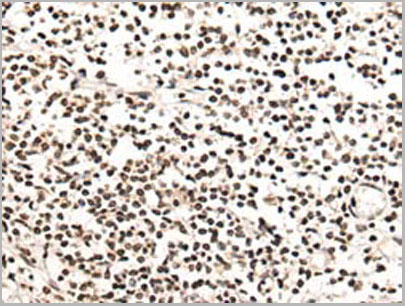 product-image-AAA22144_IHC2.jpg