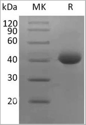 product-image-AAA22155_SDS_PAGE.jpg