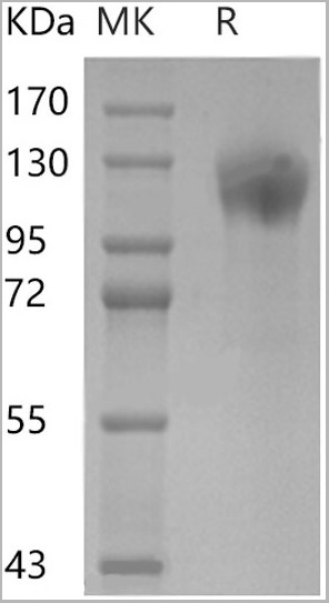 product-image-AAA22156_SDS_PAGE.jpg