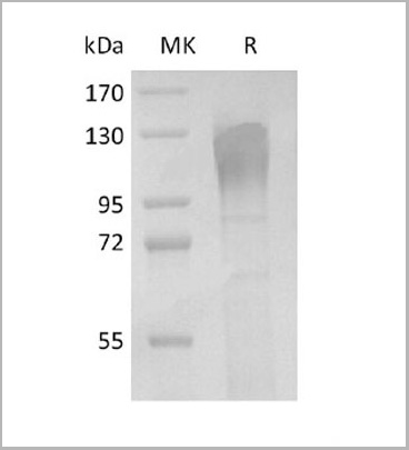 product-image-AAA22157_SDS_PAGE.jpg