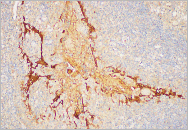 product-image-AAA22172_IHC2.jpg