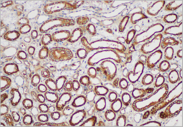 product-image-AAA22172_IHC3.jpg